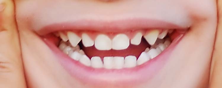 dream dictionary teeth
